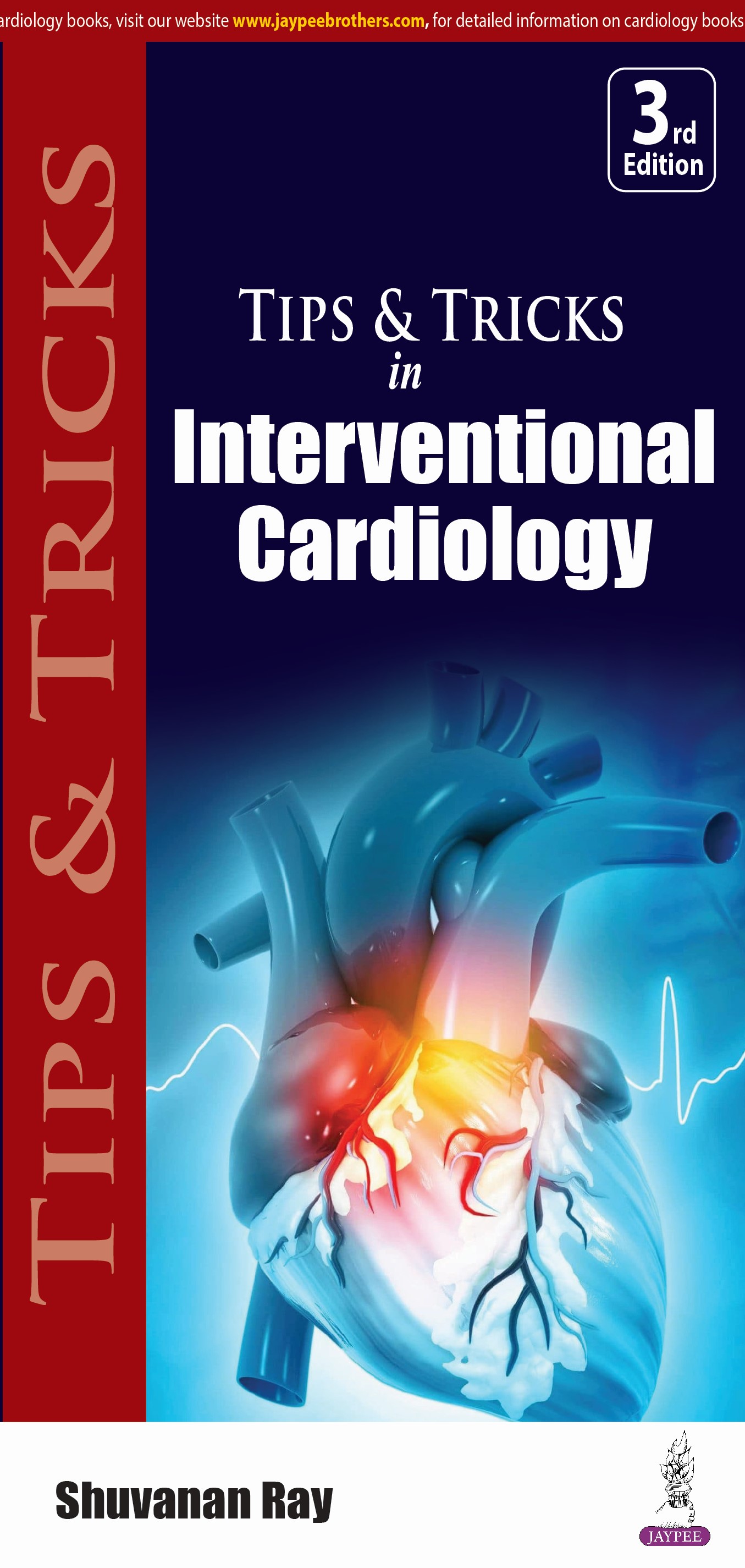 Tips and Tricks In Interventional Cardiology 3rd/2024 - Best Online ...